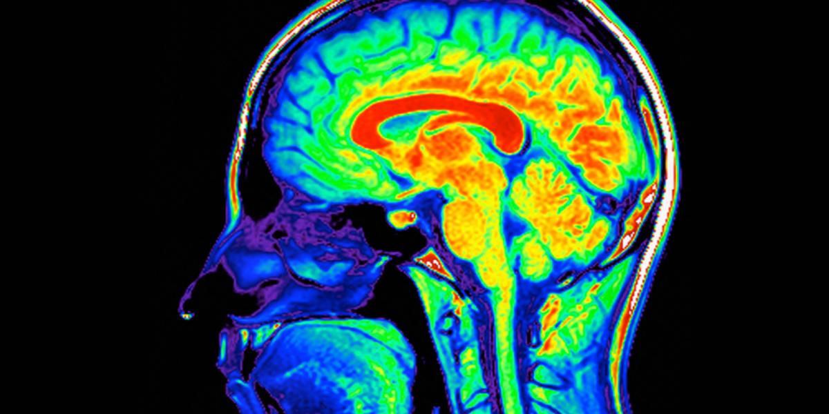 Az emberi agy – bizonyos idegélettani vizsgálatok arra 
utalnak, hogy döntéseink akár másodpercekkel tudatosulásuk előtt megszületnek 