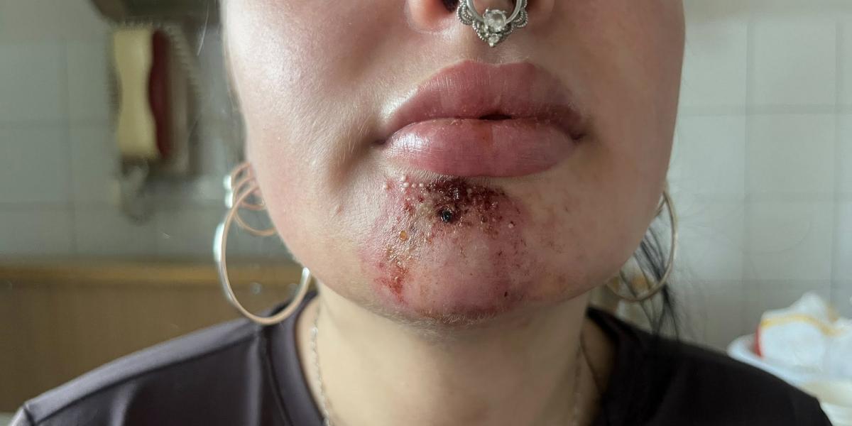 A nő állapota a kórházba kerüléskor 