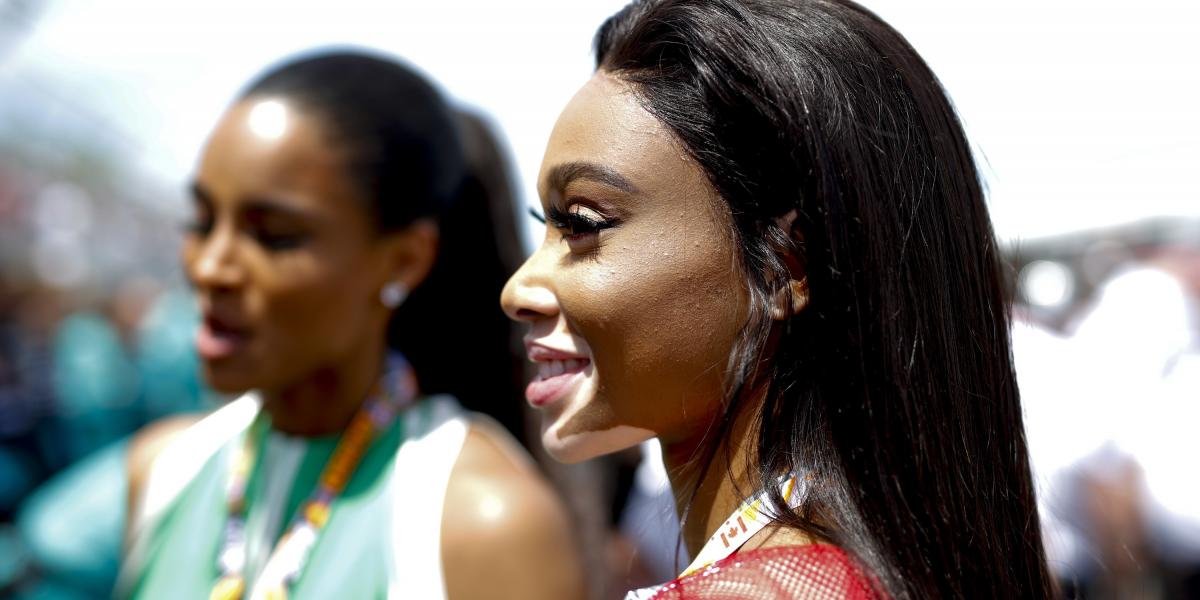 Winnie Harlow - AFP fotó