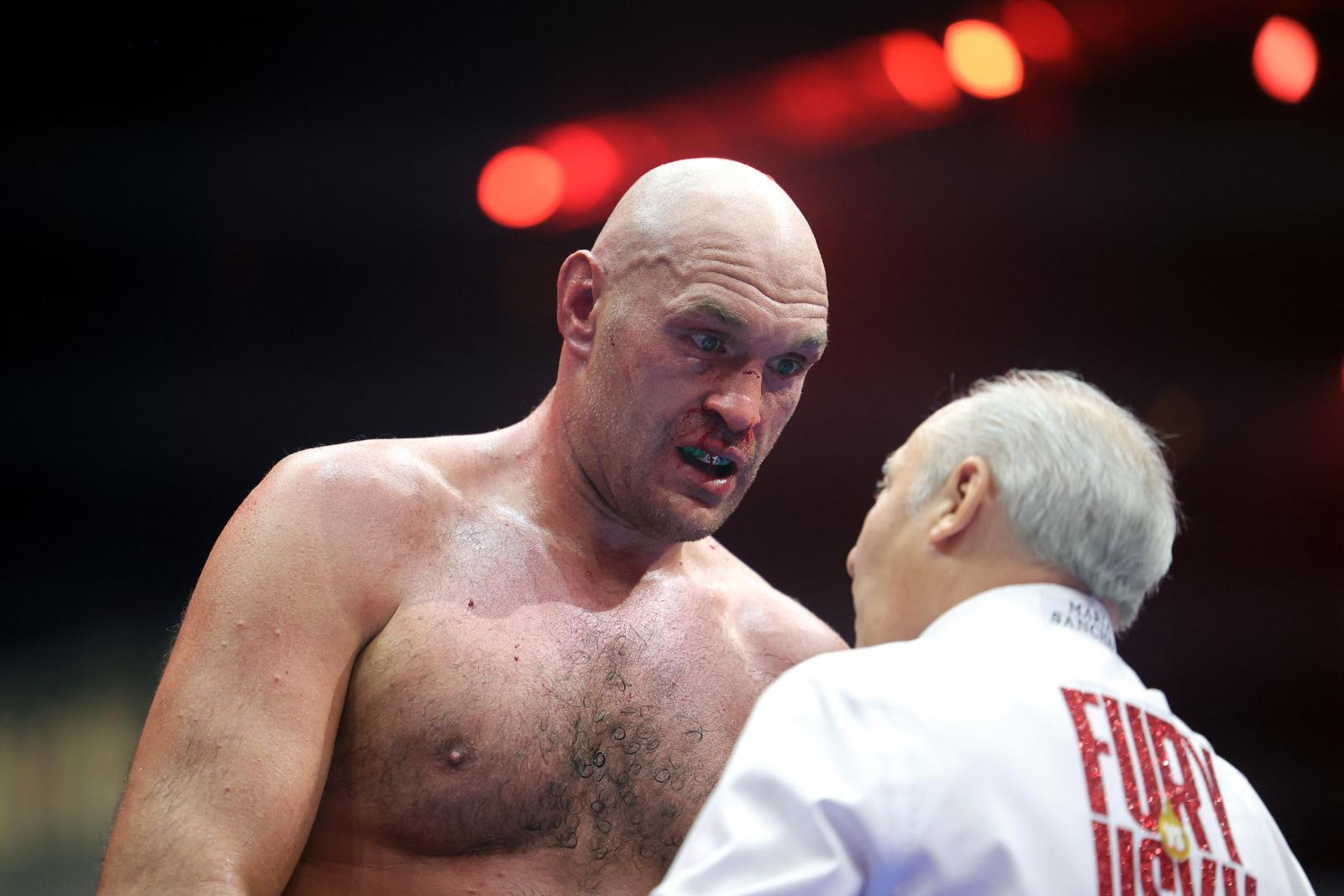 Tyson Fury vereségéért októberben venne revánsot