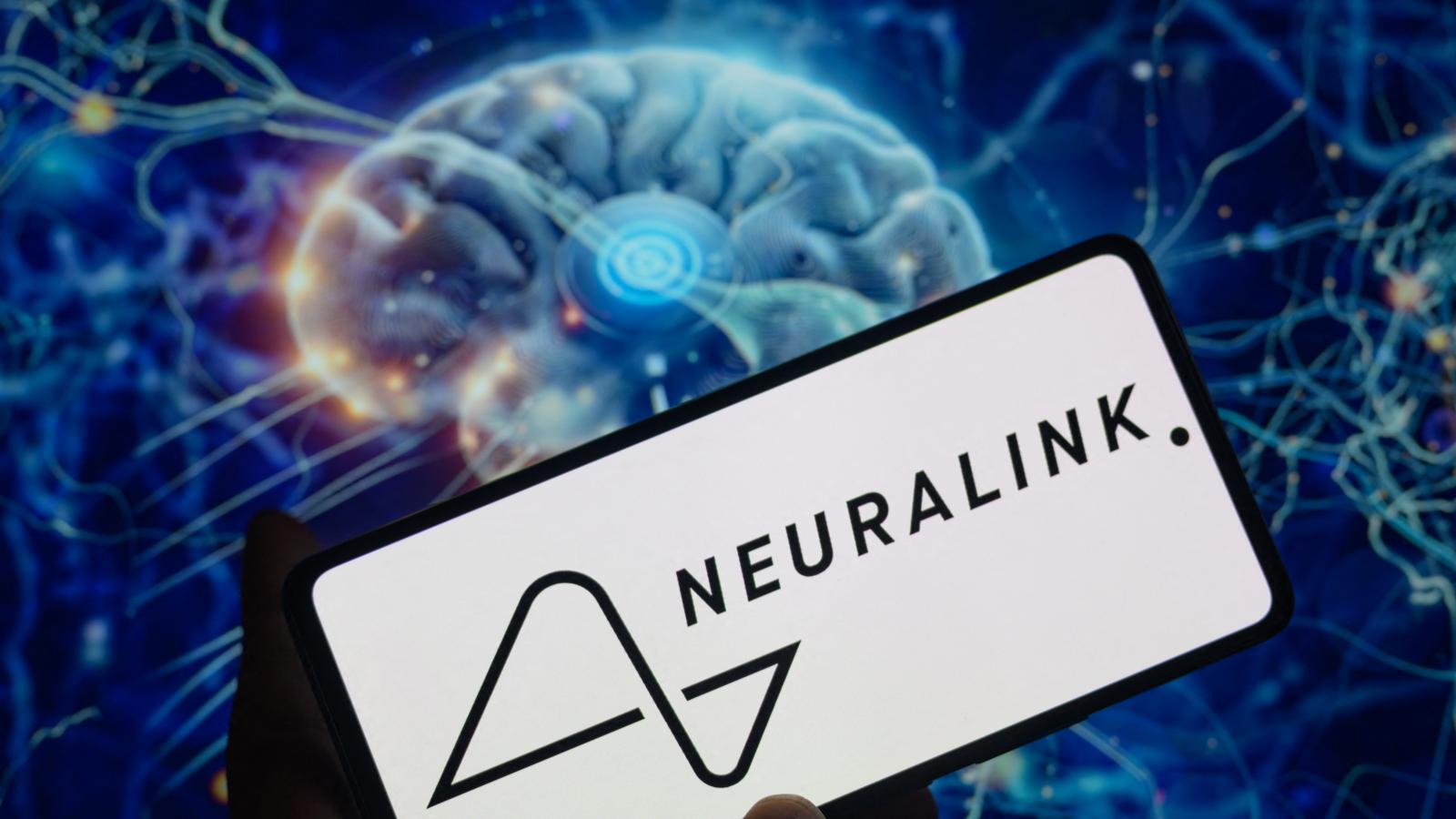 A pénzérme nagyságú implantátumnak 1024 elektródája van, amelyekkel az agysejtek hálózatába kapcsolódik, és az aktivitásuk jeleit a Neuralink számítógépébe továbbítja, amely azután a kurzort irányítja