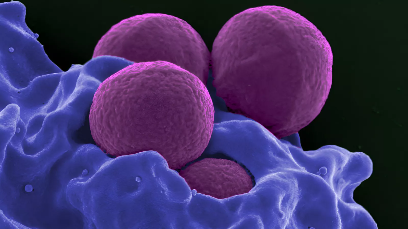 Egy multirezisztens baktérium, a staphylococcus aureus