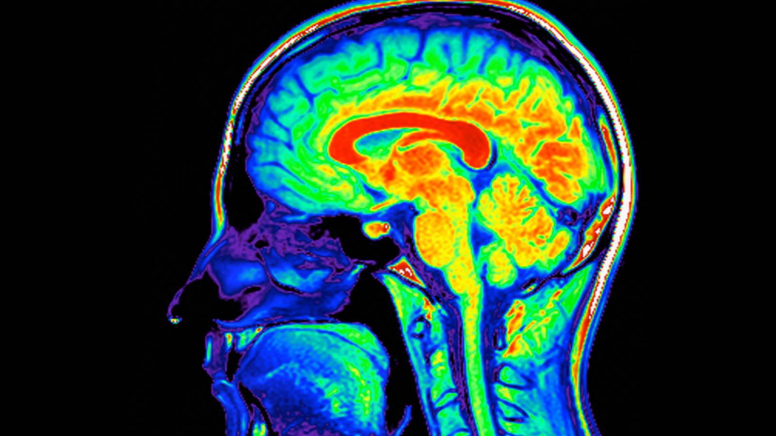 Az emberi agy – bizonyos idegélettani vizsgálatok arra
utalnak, hogy döntéseink akár másodpercekkel tudatosulásuk előtt megszületnek